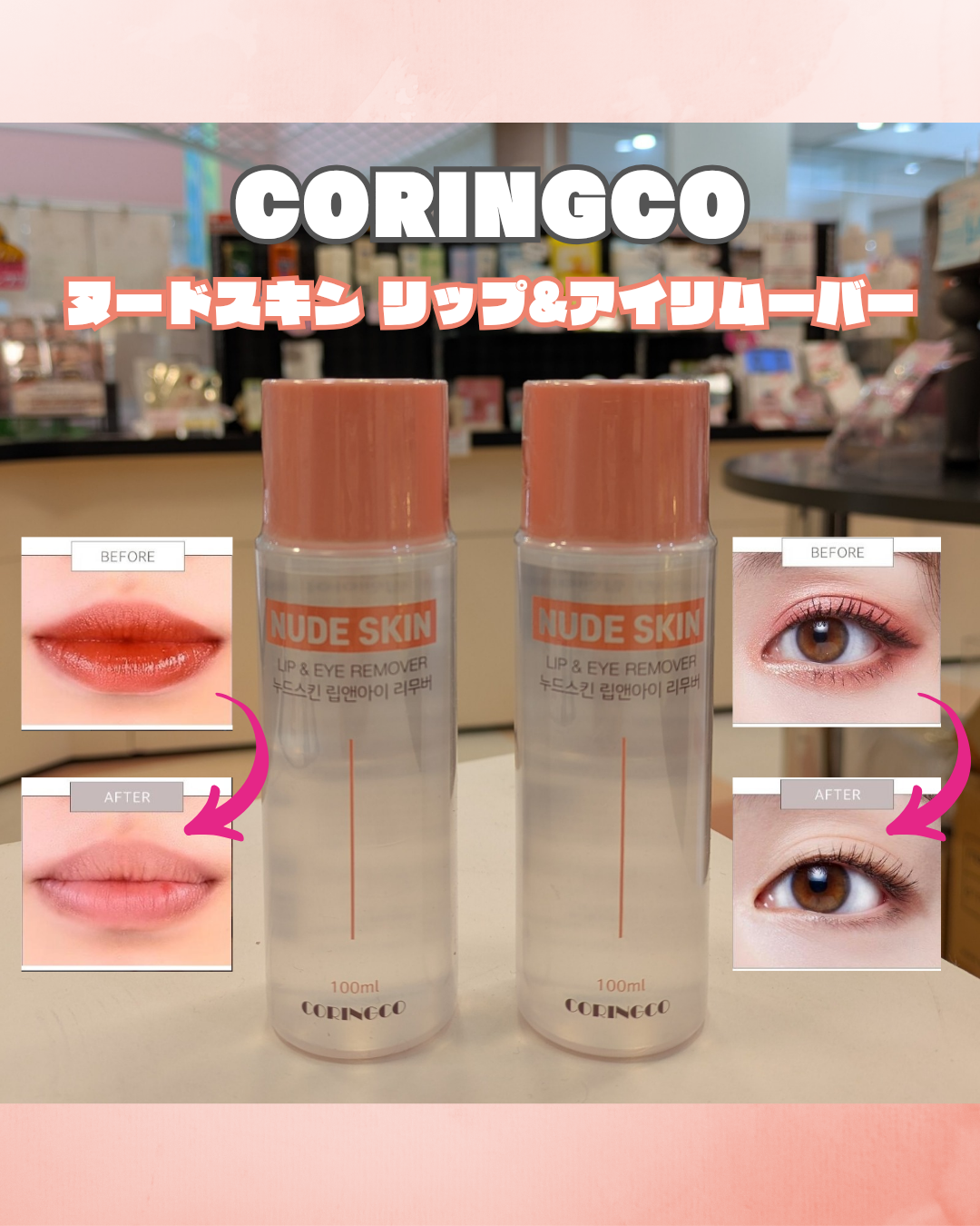 NEW！リムーバー♡